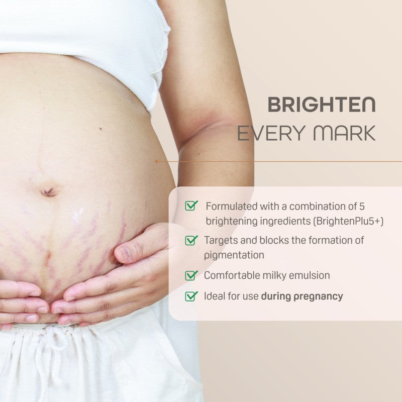 Pigeon Natural Botanical Maternity Stretch Mark Serum 40ML