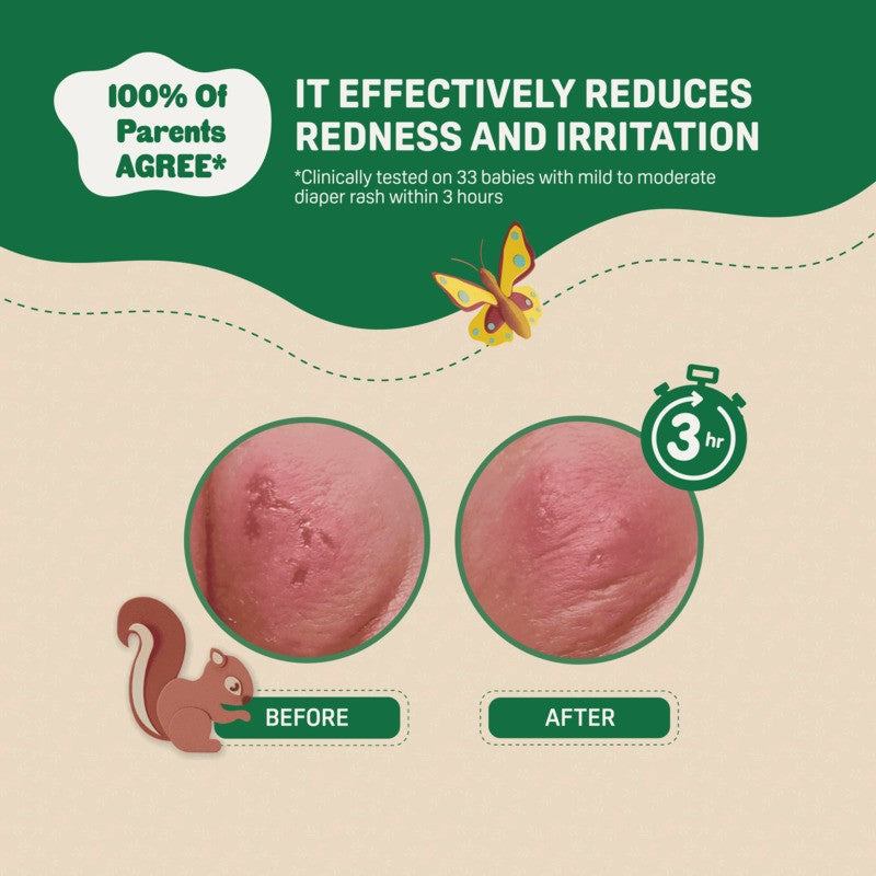 Pigeon Natural Botanical Newborn Diaper Cream 50ml